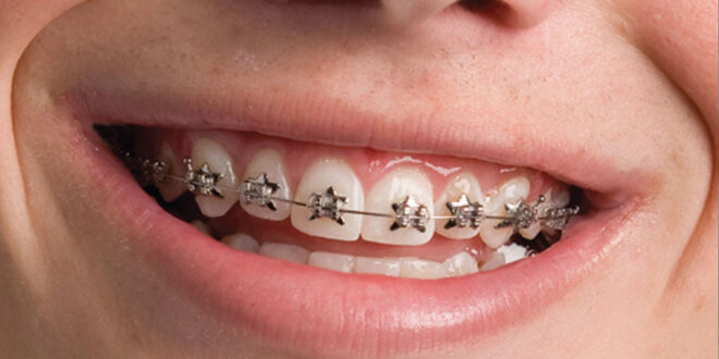 The Ins And Outs Of Orthodontic Dentistry