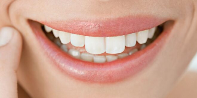 The Latest Dental Trends for Achieving the Perfect Smile