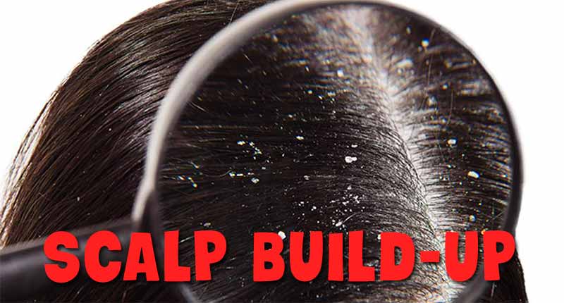 How to clean scalp build-up