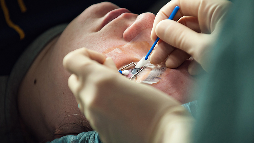How Much Does Lasik Eye Surgery Cost?
