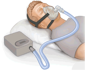 Why people need Oxygen Therapy Treatment and how can it help them overcome various illnesses?