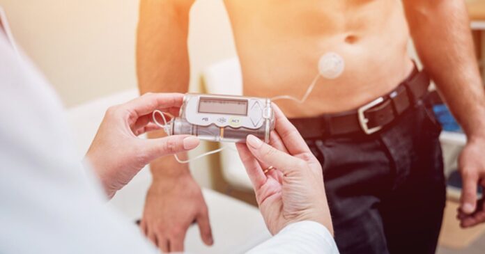 Remembering Important Things About Your Insulin Pump