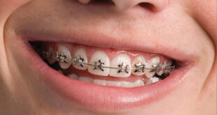 The Ins And Outs Of Orthodontic Dentistry
