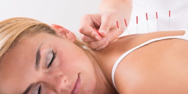 Acupuncture: Say Bye To Medicines
